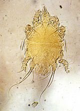 Acarapis Woodi
